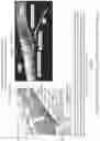 Fig. 59 - SYSTEMS AND METHODS FOR OCULAR LASER SURGERY AND THERAPEUTIC TREATMENTS