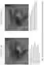 Fig. 67 - SYSTEMS AND METHODS FOR OCULAR LASER SURGERY AND THERAPEUTIC TREATMENTS