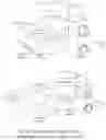 Fig. 79 - SYSTEMS AND METHODS FOR OCULAR LASER SURGERY AND THERAPEUTIC TREATMENTS