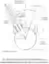 Fig. 90 - SYSTEMS AND METHODS FOR OCULAR LASER SURGERY AND THERAPEUTIC TREATMENTS