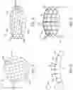 Fig. 05 - Dressing for stumps following amputation