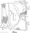 Fig. 06 - Moisture Absorbent Undergarment