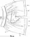 Fig. 07 - Moisture Absorbent Undergarment