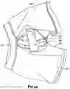 Fig. 09 - Moisture Absorbent Undergarment