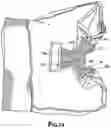Fig. 10 - Moisture Absorbent Undergarment
