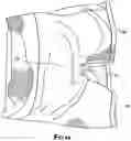 Fig. 14 - Moisture Absorbent Undergarment