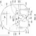 Fig. 26 - Proning frame for a patient bed