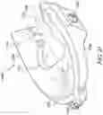 Fig. 18 - PRONING FRAME FOR A PATIENT BED