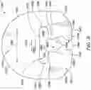 Fig. 23 - PRONING FRAME FOR A PATIENT BED