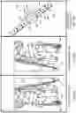Fig. 05 - Flexible exosuit for assistive mobility