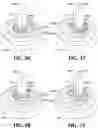 Fig. 14 - MECHANICAL COMPRESSION DEVICE WITH ADJUSTABLE COMPRESSION POINT