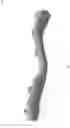 Fig. 06 - TRIGGER POINT ROCKER