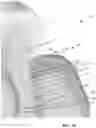 Fig. 03 - Periodontic treatment and method