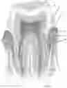 Fig. 04 - Periodontic treatment and method