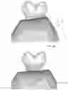 Fig. 06 - Periodontic treatment and method