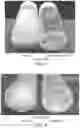 Fig. 03 - METHOD OF ENHANCING THE EFFICACY AND STABILITY OF INGREDIENTS IN SUSPENSIONS
