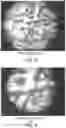Fig. 04 - METHOD OF ENHANCING THE EFFICACY AND STABILITY OF INGREDIENTS IN SUSPENSIONS
