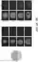 Fig. 14 - MICROFLUIDICS DEVICE FOR FABRICATION OF LARGE, UNIFORM, INJECTABLE HYDROGEL MICROPARTICLES FOR CELL ENCAPSULATION