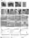 Fig. 11 - Compositions and methods for inhibiting post-surgical adhesions