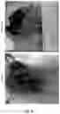 Fig. 12 - Compositions and methods for inhibiting post-surgical adhesions