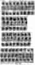 Fig. 17 - Compositions and methods for inhibiting post-surgical adhesions