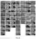 Fig. 18 - Compositions and methods for inhibiting post-surgical adhesions