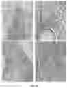 Fig. 19 - Compositions and methods for inhibiting post-surgical adhesions
