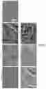 Fig. 27 - Compositions and methods for inhibiting post-surgical adhesions