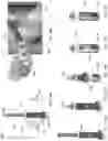 Fig. 16 - Systems and methods for removing a covering from a bodily surface