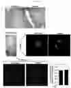 Fig. 09 - TRIPLE COMBINATION FORMULATION FOR TREATMENT OF CHRONIC PAIN