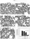 Fig. 12 - TRIPLE COMBINATION FORMULATION FOR TREATMENT OF CHRONIC PAIN