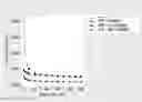 Fig. 01 - Ready-to-use injectable formulations
