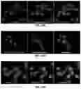 Fig. 16 - Biologically active ganoderma lucidum compounds and synthesis of anticancer derivatives; ergosterol peroxide probes for cellular localization