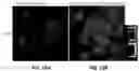 Fig. 20 - Biologically active ganoderma lucidum compounds and synthesis of anticancer derivatives; ergosterol peroxide probes for cellular localization