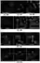 Fig. 21 - Biologically active ganoderma lucidum compounds and synthesis of anticancer derivatives; ergosterol peroxide probes for cellular localization