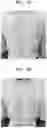 Fig. 11 - INJECTABLE COMPOSITION FOR INDUCING LIPOLYSIS AND METHOD USING THE SAME