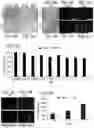 Fig. 11 - COMPOSITIONS AND METHODS FOR TREATING CANCER