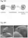 Fig. 15 - Silicified immunogenic cells, methods of making, and methods of using