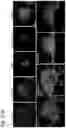 Fig. 21 - Silicified immunogenic cells, methods of making, and methods of using