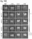 Fig. 31 - Silicified immunogenic cells, methods of making, and methods of using