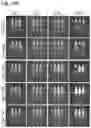 Fig. 33 - Silicified immunogenic cells, methods of making, and methods of using