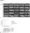 Fig. 14 - BAFF-R/CD19 TARGETED CHIMERIC ANTIGEN RECEPTOR-MODIFIED T CELLS AND USE THEREOF