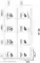 Fig. 22 - ANTI-ALPP CAR-T CELL THERAPY