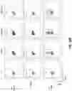 Fig. 32 - ANTI-ALPP CAR-T CELL THERAPY