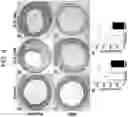 Fig. 05 - PHARMACEUTICAL COMPOSITION FOR PREVENTING IN-STENT RESTENOSIS