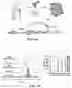 Fig. 12 - MATERIALS AND METHODS FOR BONE MARROW TRANSPLANTATION