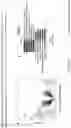 Fig. 19 - MATERIALS AND METHODS FOR BONE MARROW TRANSPLANTATION