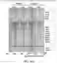 Fig. 38 - MATERIALS AND METHODS FOR BONE MARROW TRANSPLANTATION