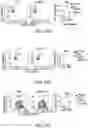Fig. 56 - MATERIALS AND METHODS FOR BONE MARROW TRANSPLANTATION
