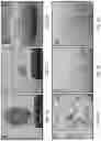 Fig. 03 - USE OF OVARIAN-DERIVED HYDROGELS FOR RESTORATION OF REPRODUCTIVE FUNCTION AND HEALTH IN WOMEN